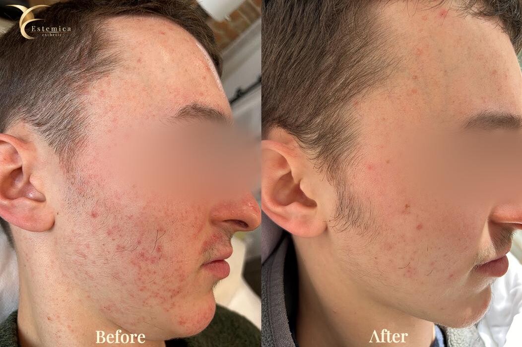 Images Estemica Esthetic