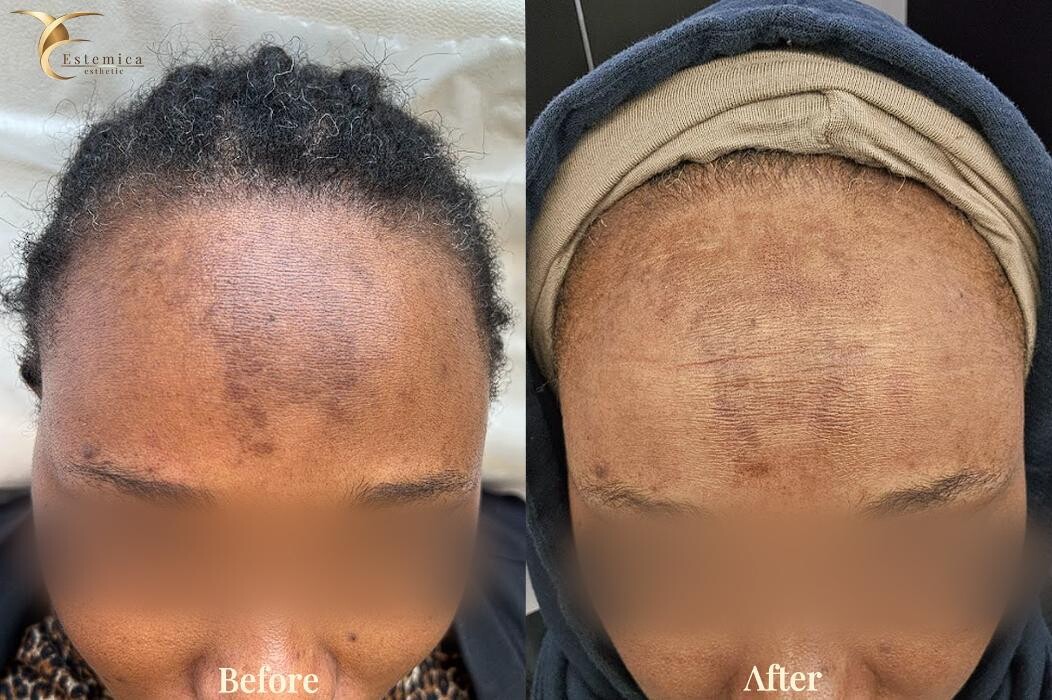 Images Estemica Esthetic