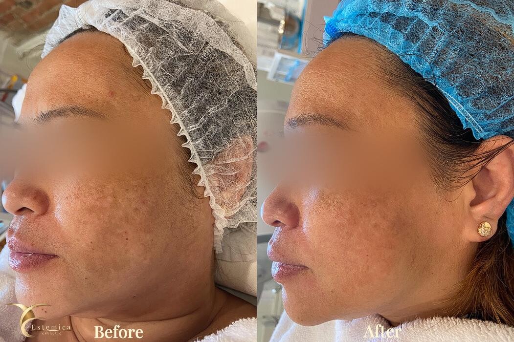 Images Estemica Esthetic