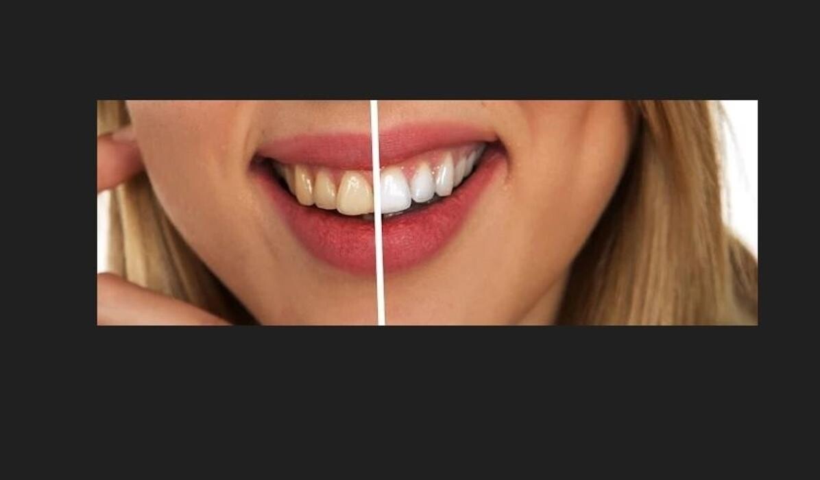 Images Whyte Ave Dental Clinic