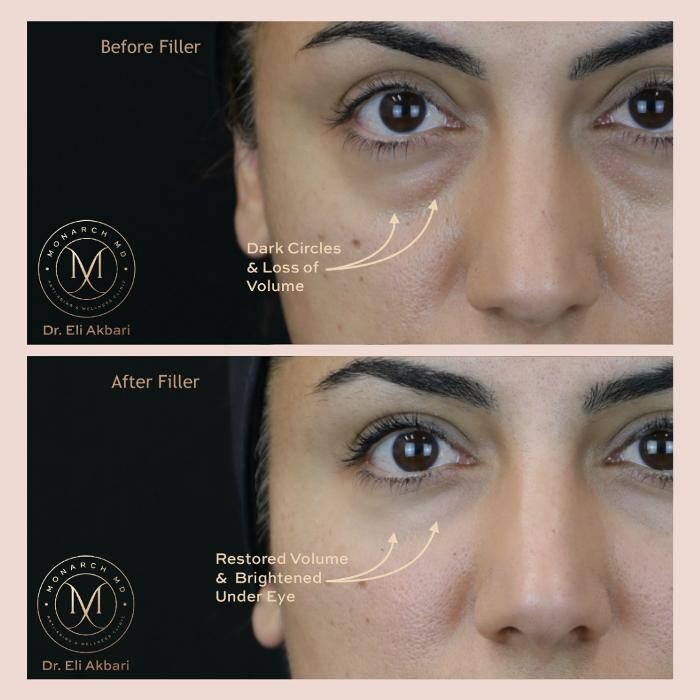 Images Monarch MD Medical Aesthetics by Dr. Eli Akbari, MD, FRCSC.