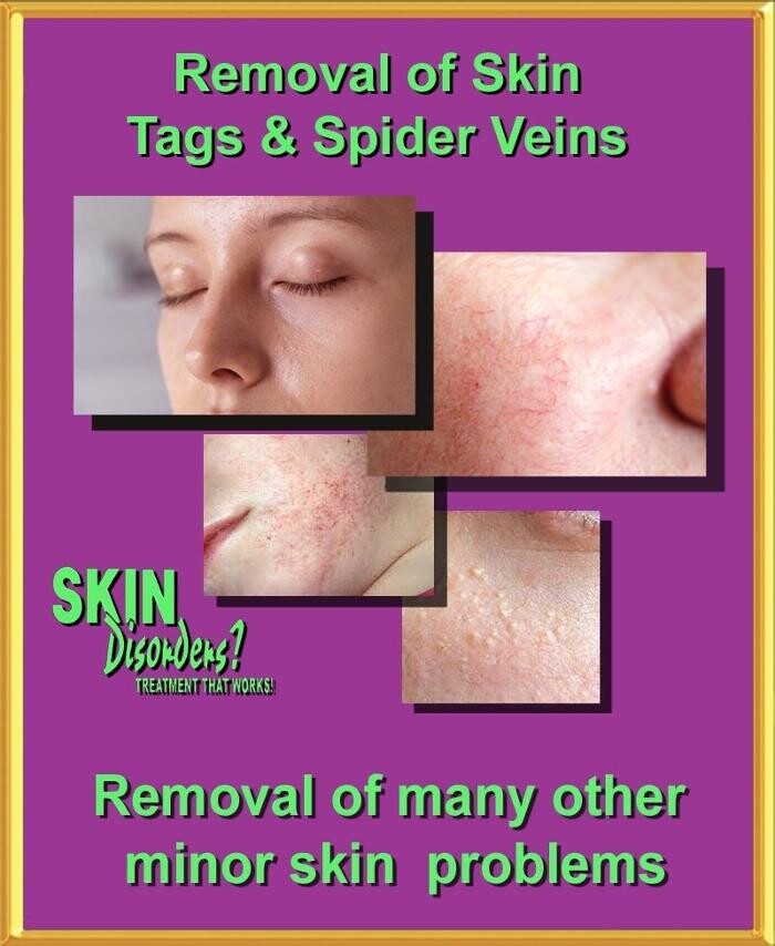 Images Advanced Therapeutic Skin Care Centre DivModernElectrolysis Inc