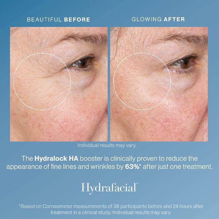 Images Mélanie Duchesneau -Hydrafacial