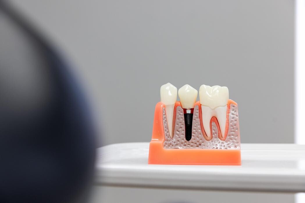 Images Centre Dentaire Familial Du Richelieu