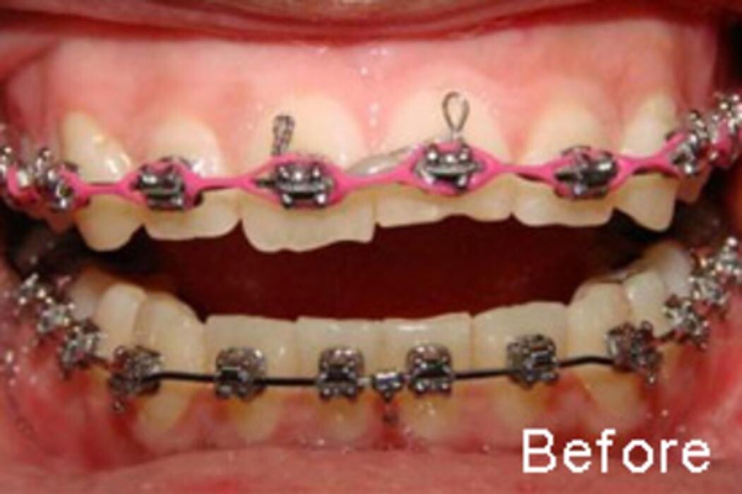 Images Tyler Dental Artz
