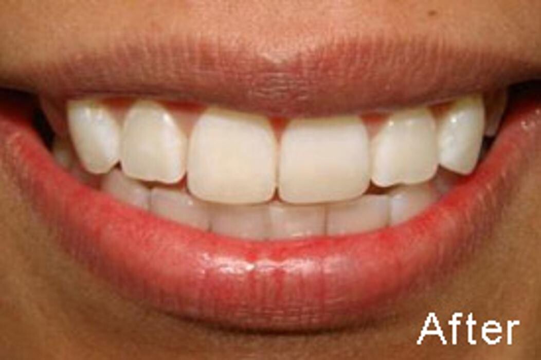 Images Tyler Dental Artz