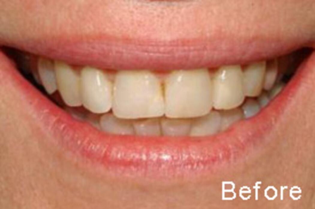 Images Tyler Dental Artz