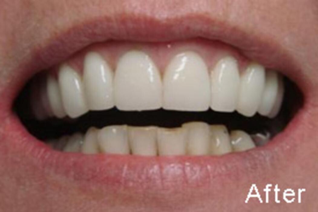 Images Tyler Dental Artz