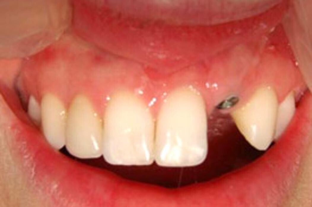 Images Tyler Dental Artz