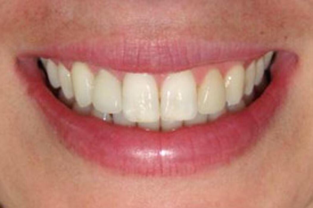 Images Tyler Dental Artz