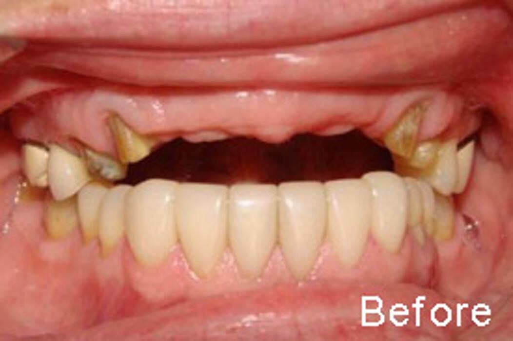Images Tyler Dental Artz
