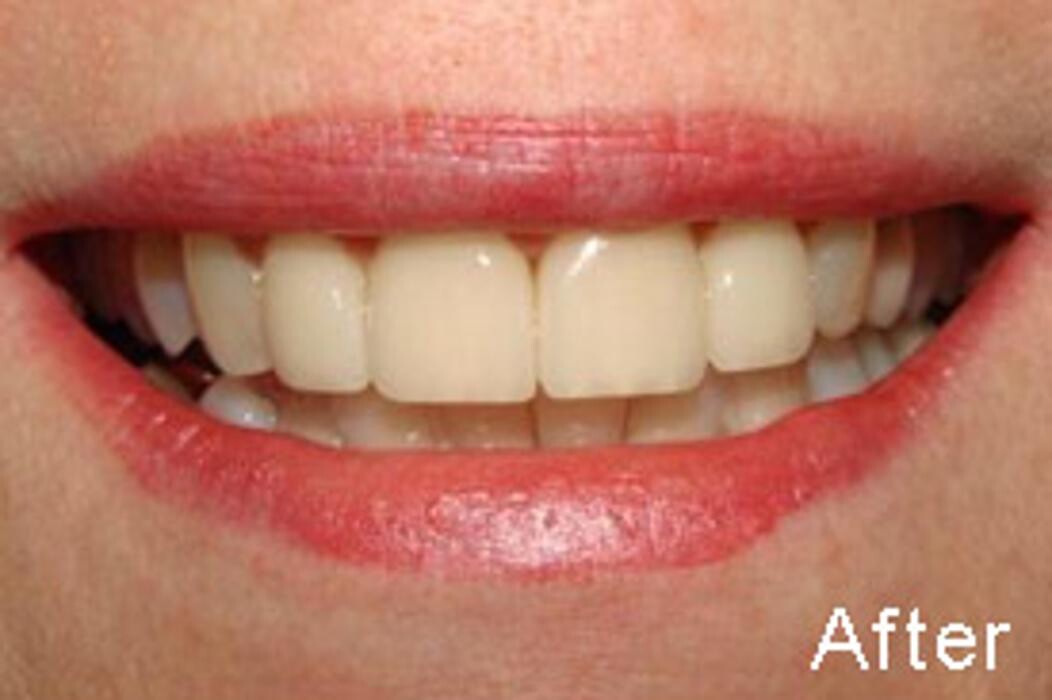 Images Tyler Dental Artz