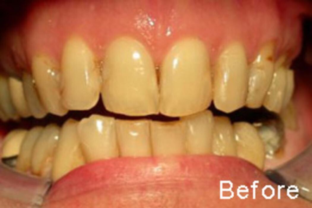 Images Tyler Dental Artz