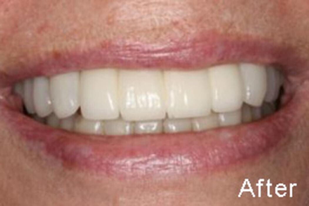 Images Tyler Dental Artz