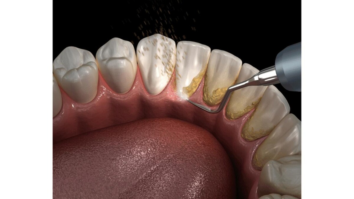 Images Dunwin Dental
