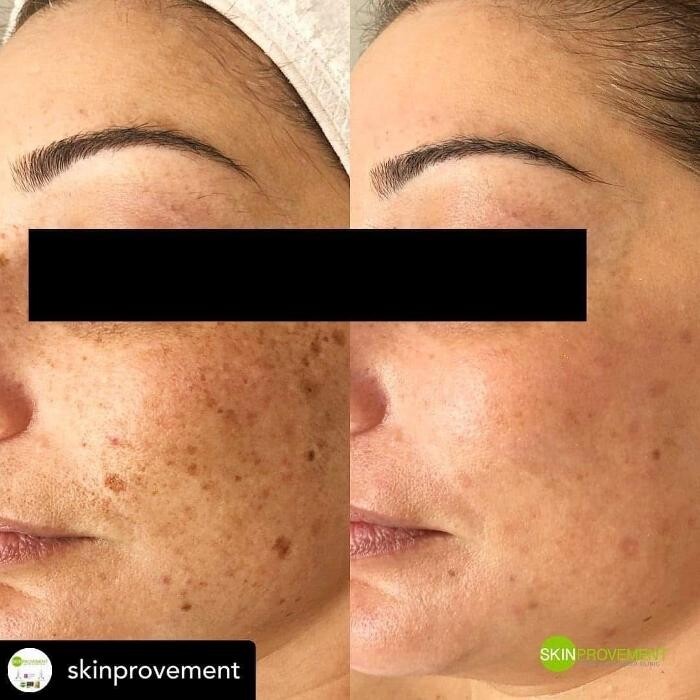 Images Esthétique Evasion