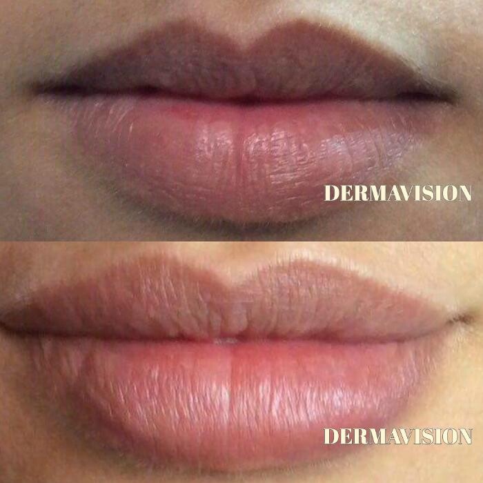 Images Dermavision