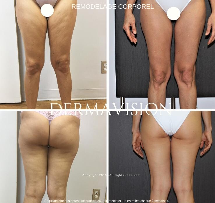 Images Dermavision