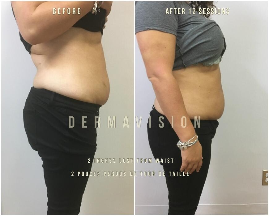 Images Dermavision