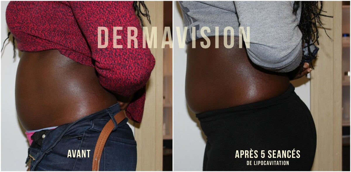 Images Dermavision