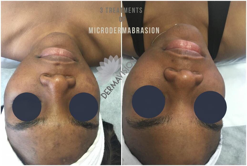 Images Dermavision
