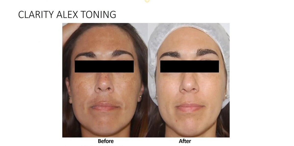 Images Dermavision