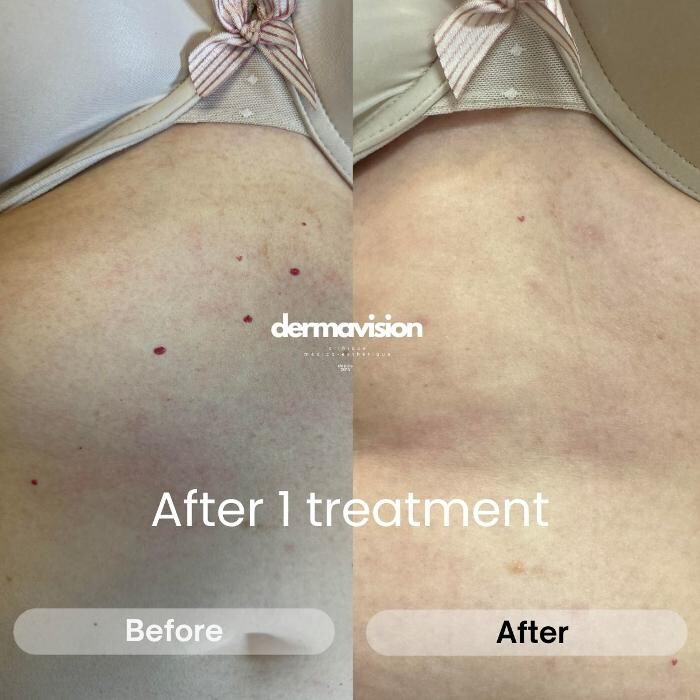 Images Dermavision