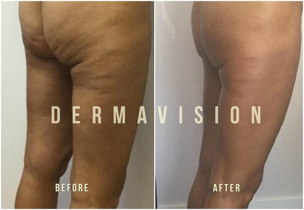 Images Dermavision