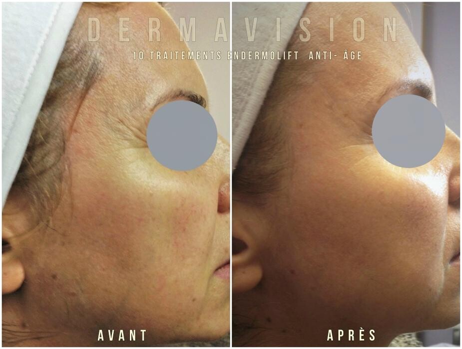 Images Dermavision