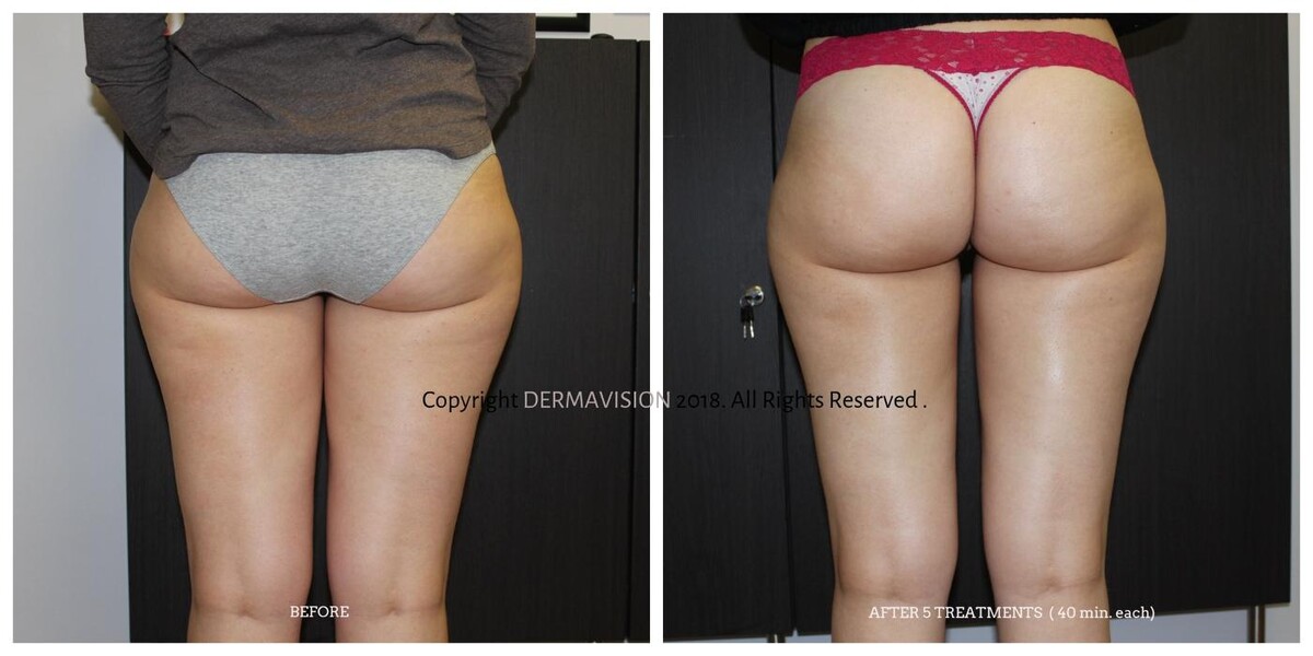 Images Dermavision