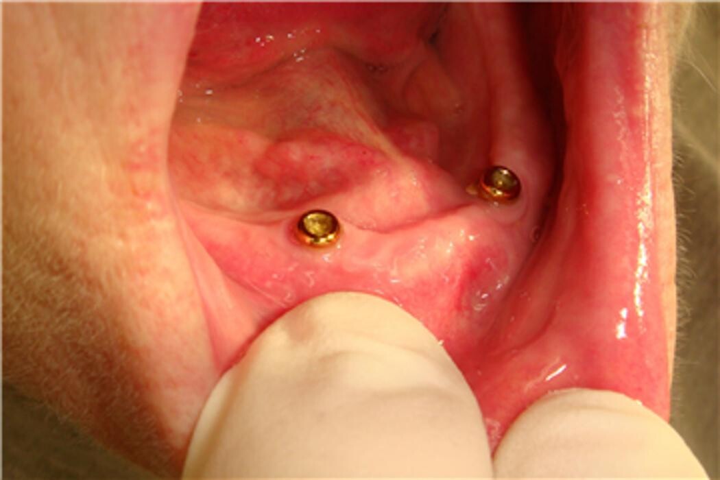 Images Precision Denture Clinic Inc