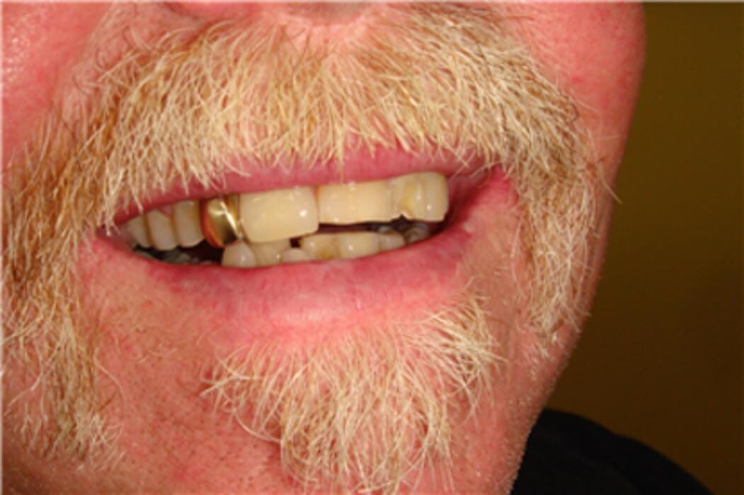 Images Precision Denture Clinic Inc