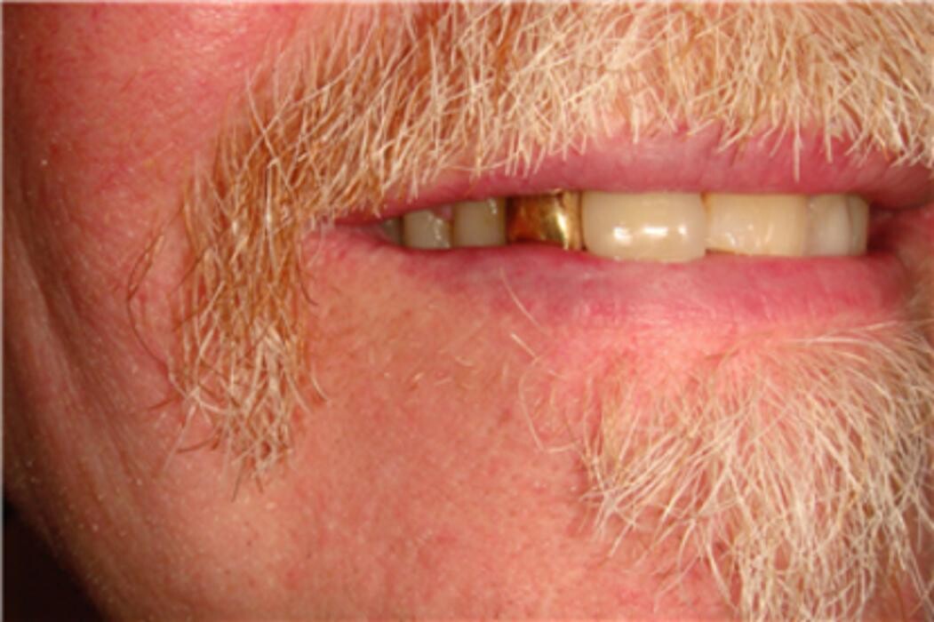 Images Precision Denture Clinic Inc