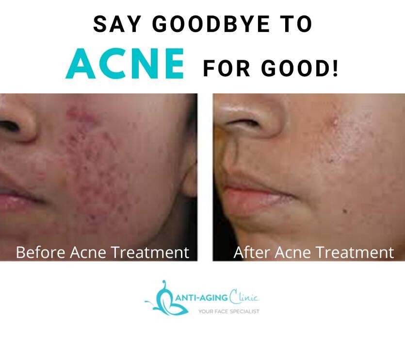 Images Anti-Aging Clinic Toronto