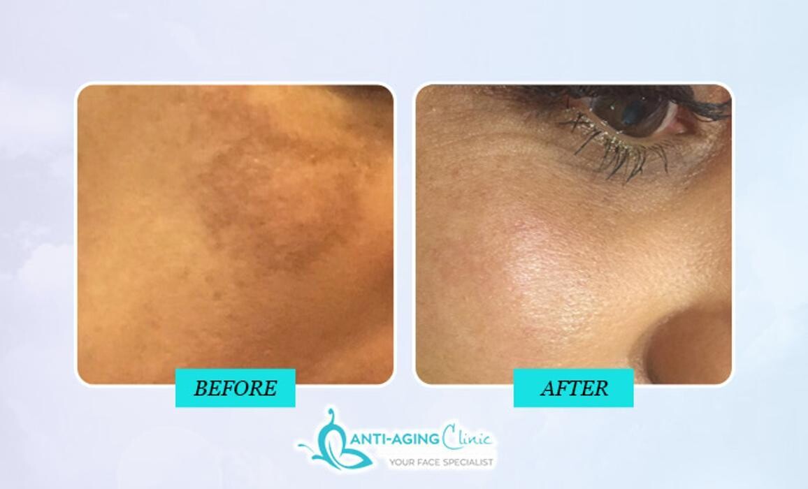 Images Anti-Aging Clinic Toronto