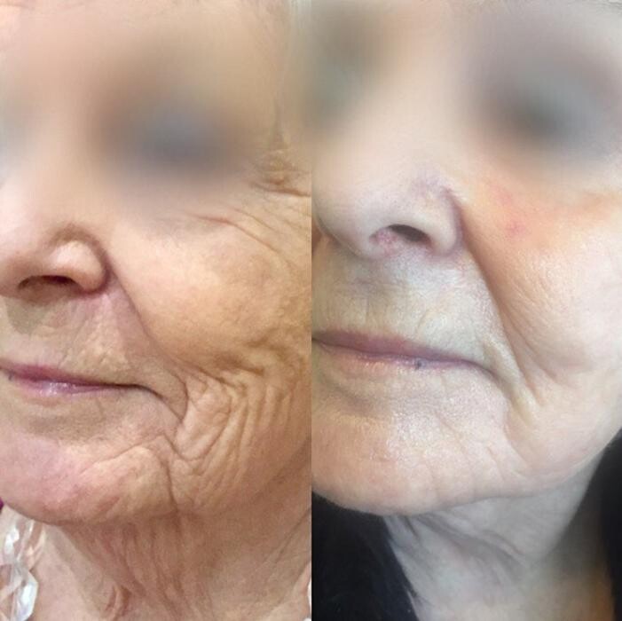 Images Anti-Aging Clinic Toronto