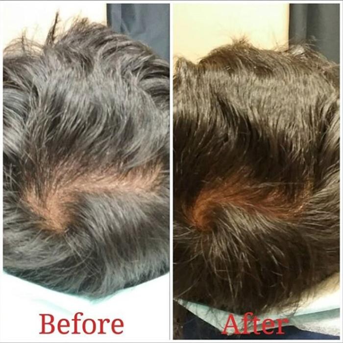 Images Anti-Aging Clinic Toronto