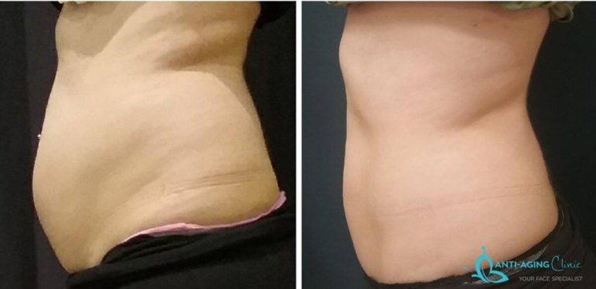 Images Anti-Aging Clinic Toronto