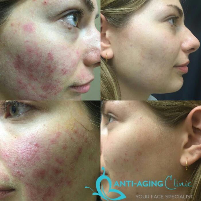 Images Anti-Aging Clinic Toronto
