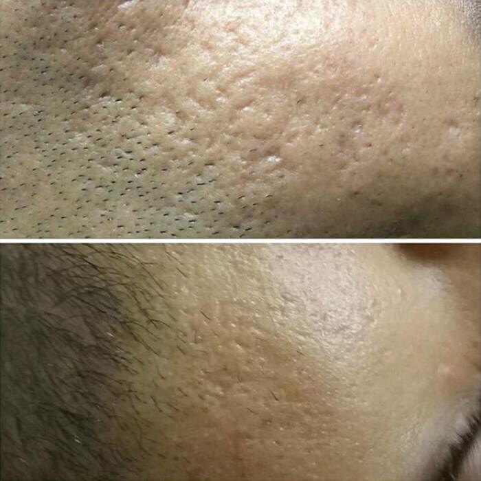 Images Anti-Aging Clinic Toronto