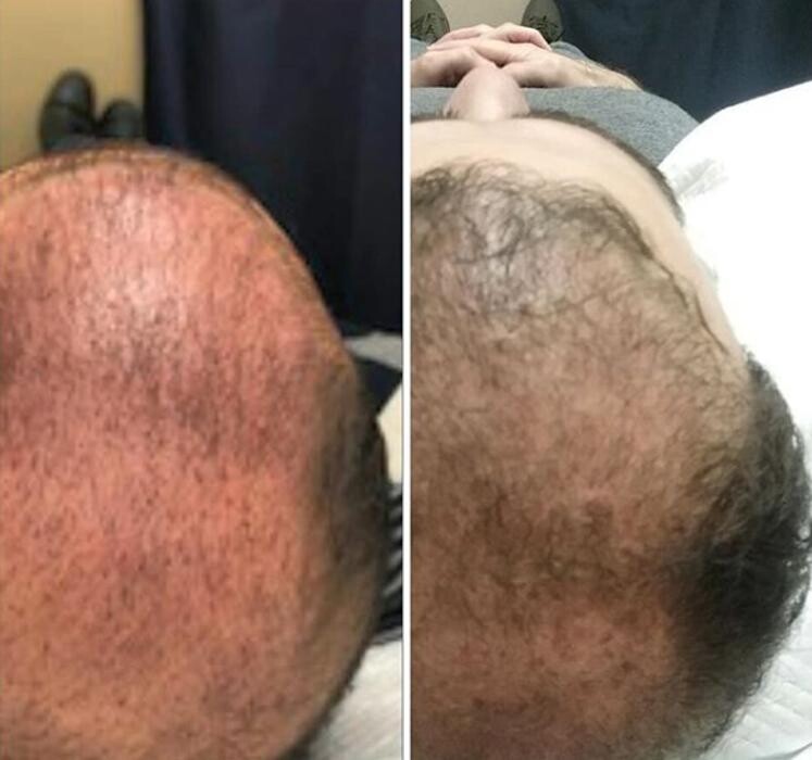 Images Anti-Aging Clinic Toronto