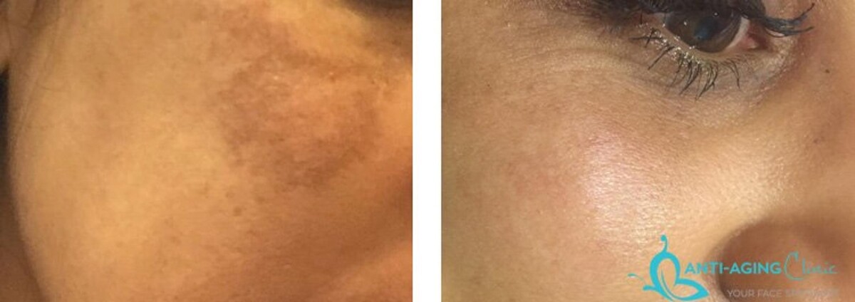 Images Anti-Aging Clinic Toronto