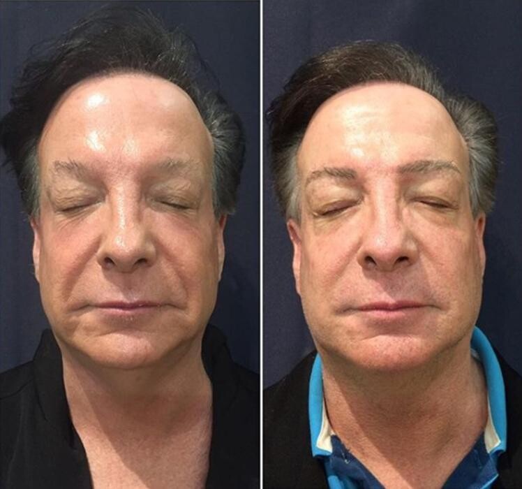 Images Anti-Aging Clinic Toronto