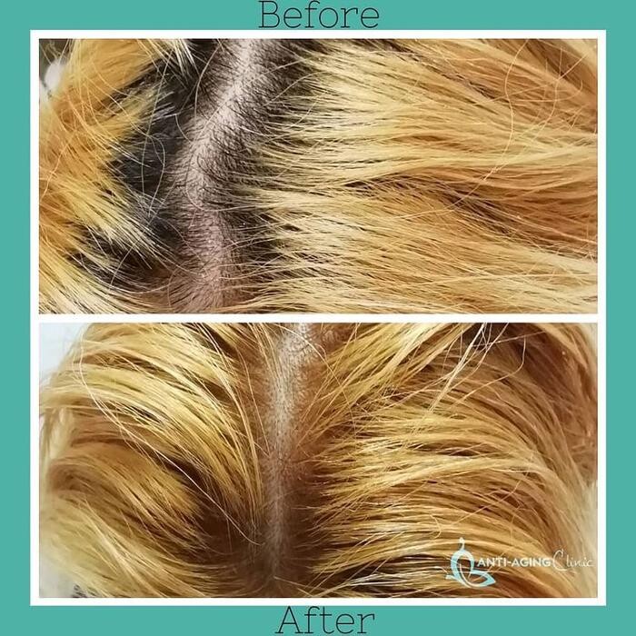 Images Anti-Aging Clinic Toronto