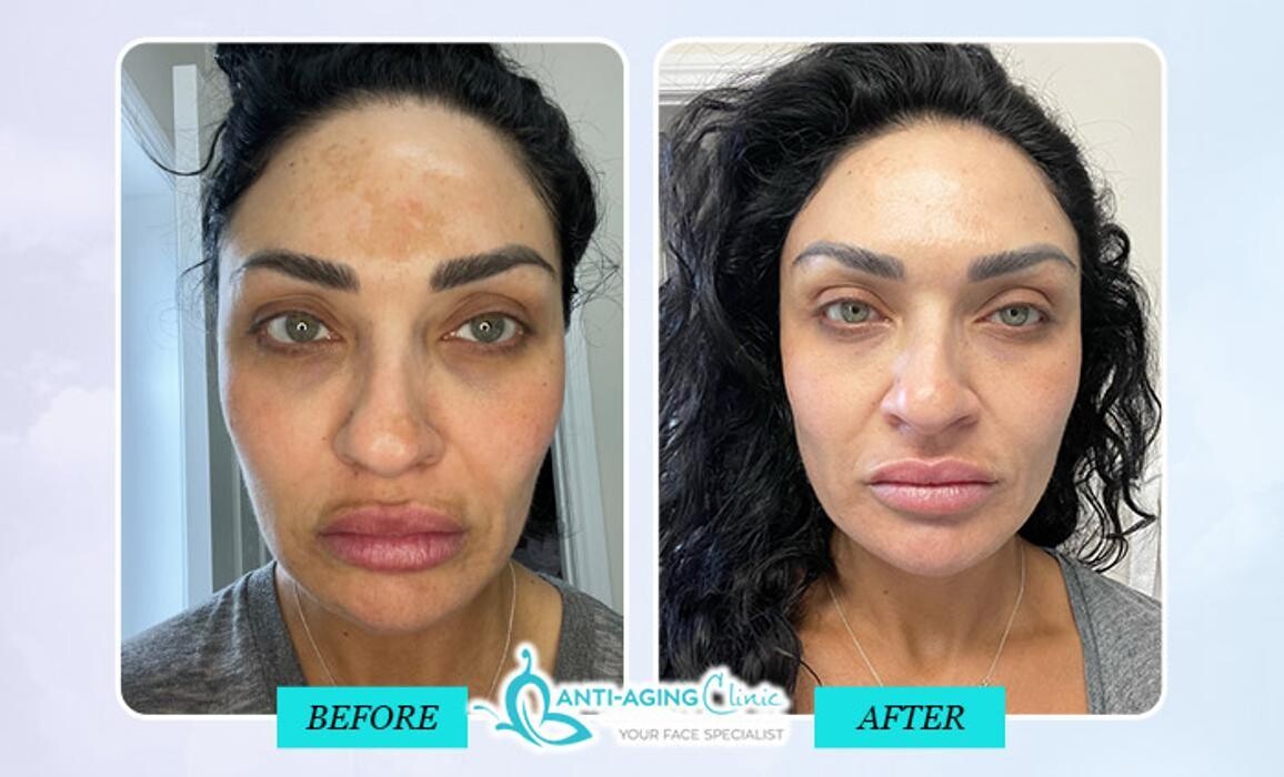 Images Anti-Aging Clinic Toronto