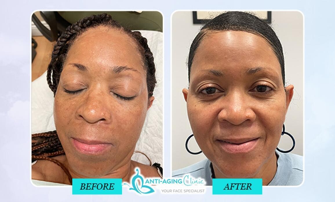 Images Anti-Aging Clinic Toronto
