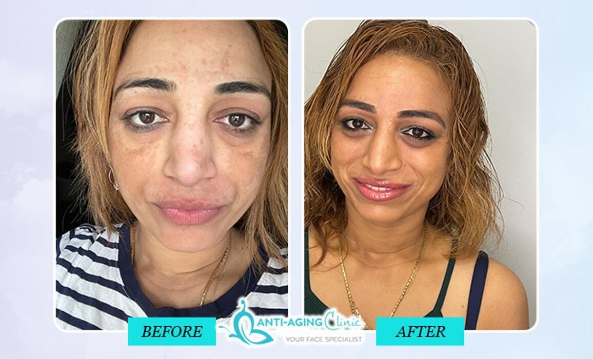 Images Anti-Aging Clinic Toronto