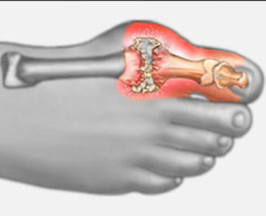 Images Rite Step Orthotics