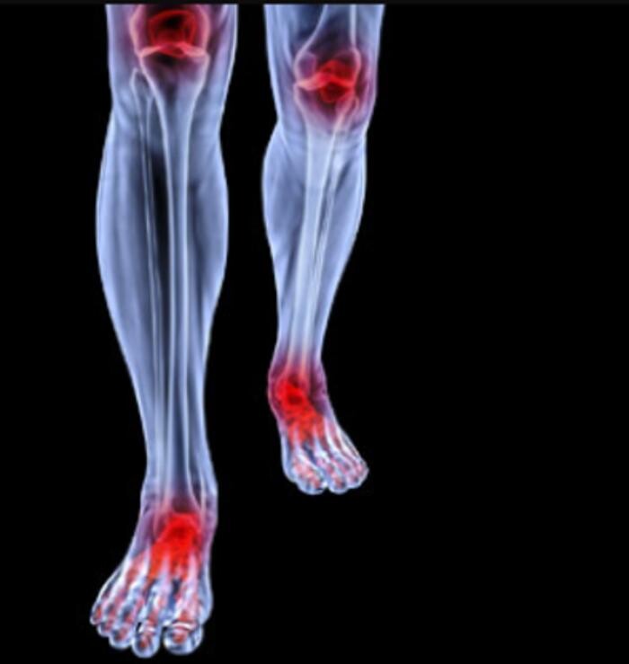Images Rite Step Orthotics