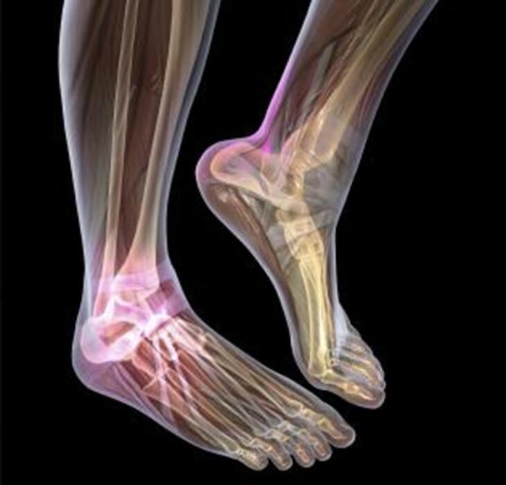 Images Rite Step Orthotics